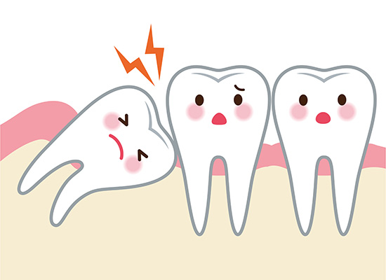 impacted-wisdom-teeth-condition